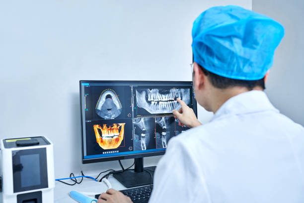 Best Knocked-Out Tooth (Avulsed Tooth) Treatment in Malaga, NJ